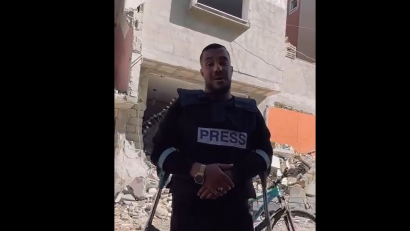 لم تمنع القدم المبتورة الصحفي الغزي حازم سليمان من توثيق جرائم الاحتلال بغزة